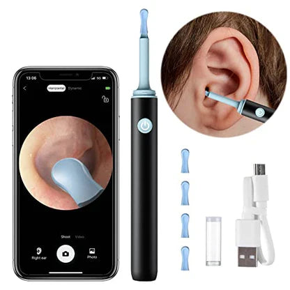 INNOVEX™   - PROFESSIONAL EAR WAX REMOVAL TOOL